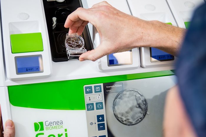 Choosing the Right Embryo Culture Incubator